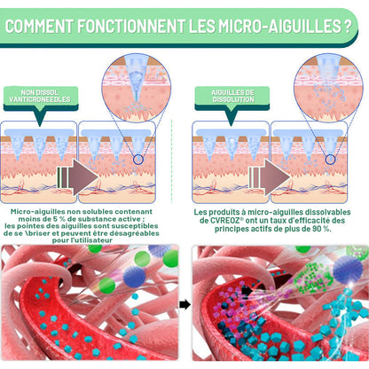 【Dernier jour de promotion : 60% DE RABAIS🏅】Cvreoz® Patch NANO de microaiguilles NIDDK-Tirzepatide pour maigrir et la santé (Sans douleur, libération 24h/24 et 7j/7 | Perd 9 kg RAPIDEMENT | Réduction de 90% du sucre | )🟩ph04